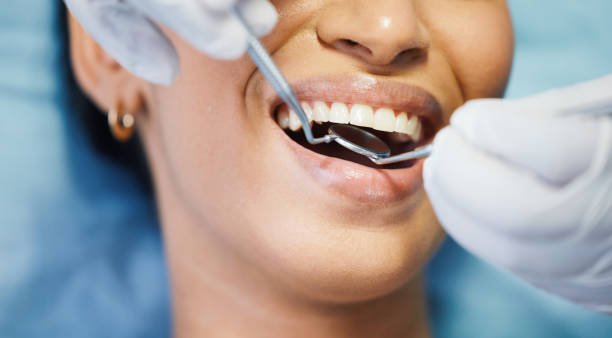 Best Emergency Dental Extractions in Middletown, OH